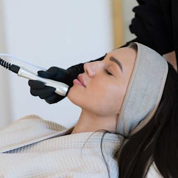 Radiofrecuencia facial