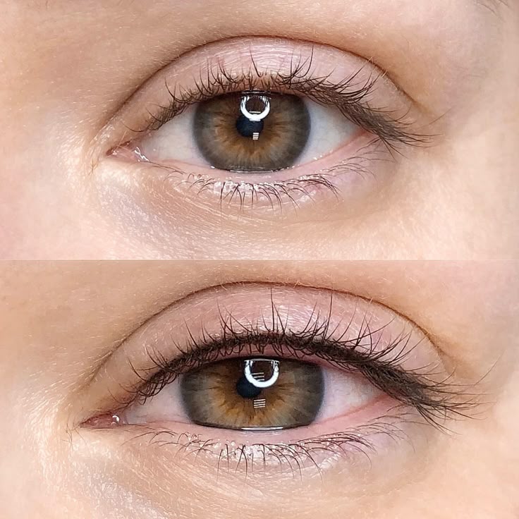 Ojos