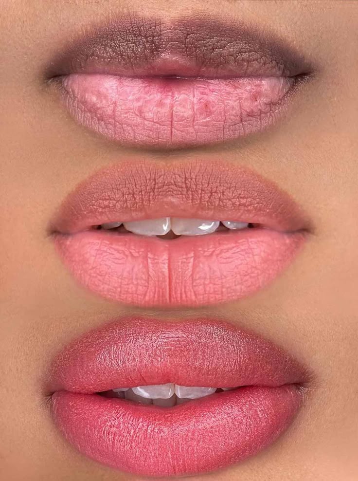 Labios